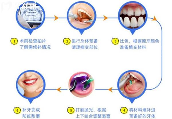 十岁孩子补牙，长大后还需要补吗