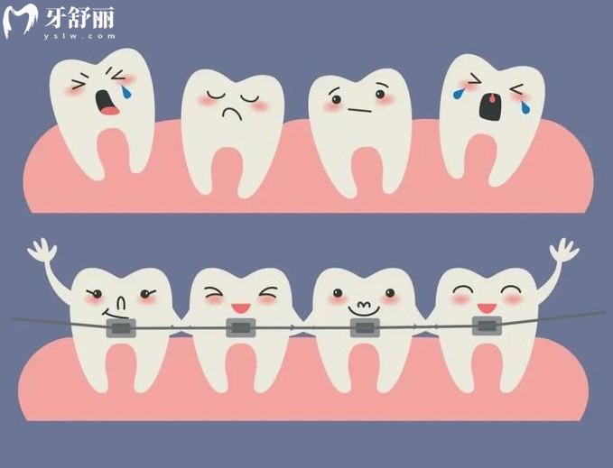 燕郊牙科诊所牙齿矫正价格表