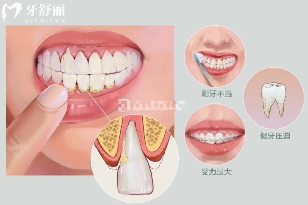 困扰国人的七大口腔问题你有几个?看看哪些日常口腔护理技巧你还不知道?