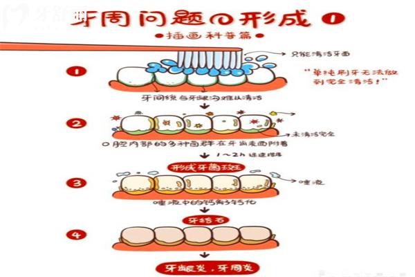 上海嘉定区哪家医院看牙周病比较好?这份上海嘉定牙科医院排名单收好不谢