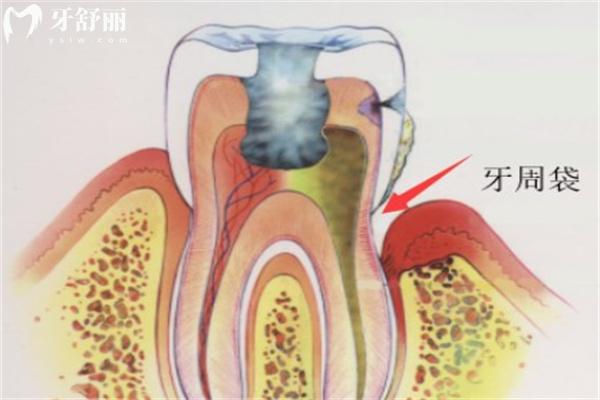 上海嘉定区哪家医院看牙周病比较好?这份上海嘉定牙科医院排名单收好不谢