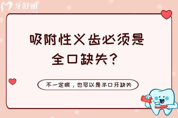 吸附性义齿必须是全口缺失