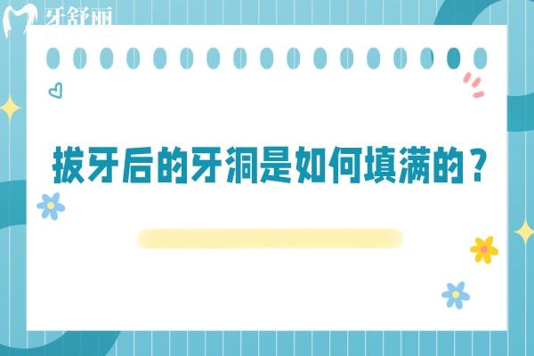 拔牙后的牙洞是如何填满的？一文了解牙洞填满的过程