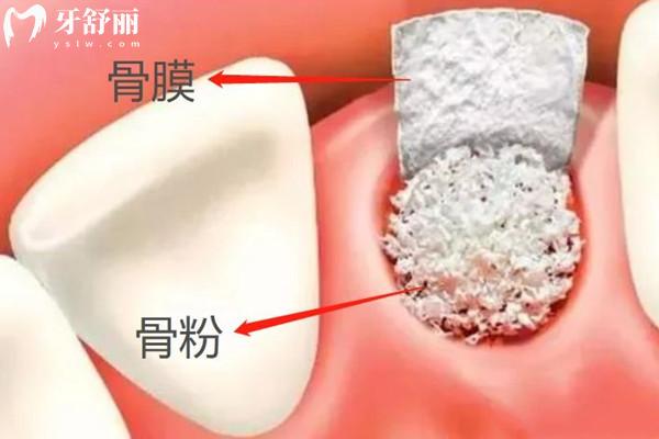 进口骨粉和国产骨粉的区别