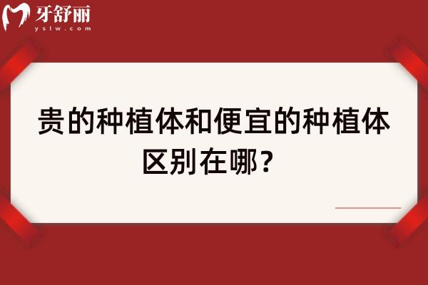 贵的种植体和便宜的种植体区别在哪？如何选择？一文知晓