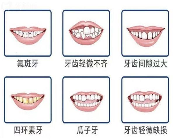 解决牙齿六大问题