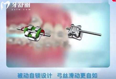 25版中山牙科医院价格表一览:种牙2680+矫牙7800+附口碑医院排名