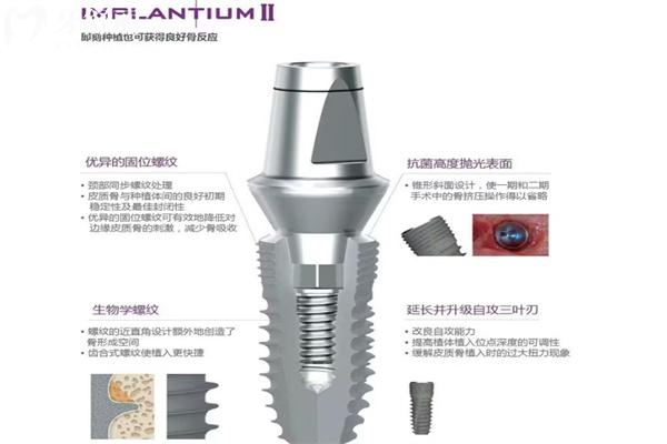 种植牙韩国登腾和奥齿泰哪个好?对比两种植体区别可知实际质量怎么样?