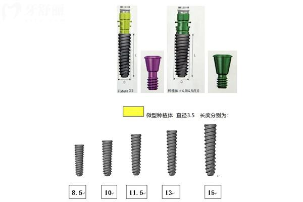 种植牙韩国登腾和奥齿泰哪个好?对比两种植体区别可知实际质量怎么样?