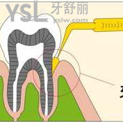 厦门登特口腔消炎药派丽奥多少钱一支？