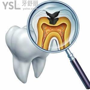 天津爱齿口腔舒适拔牙双11优惠价格