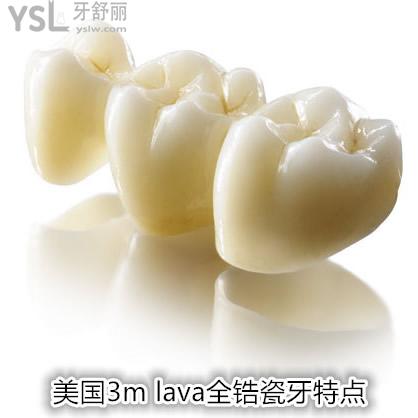 深圳雷蕾口腔诊所美国3M LAVA（拉瓦）全瓷牙价格，你知多少？