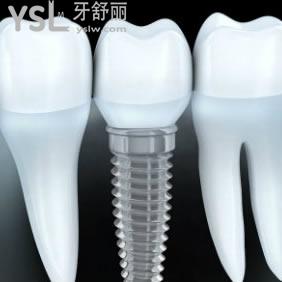 郑州拜博口腔医院价格表，韩国dentis种植牙惊爆价！