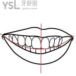 想了解你的咬合关系正常吗（看标准的牙齿咬合图片）