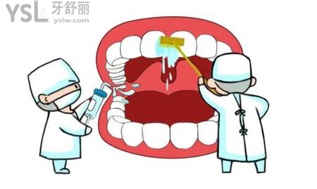 牙周炎吃什么消炎药效果好？