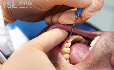 牙周病的治疗方法有哪些？