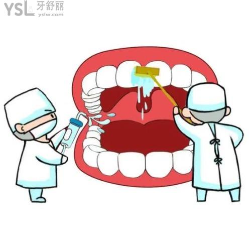 牙周炎的症状表现是什么？