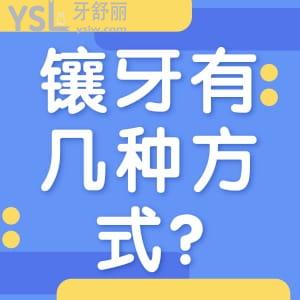 镶牙有几种方式?镶牙要多少钱一颗?