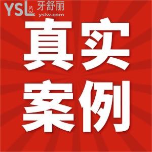 去无锡维乐口腔门诊部看牙是怎样的体验？真实评价在这里