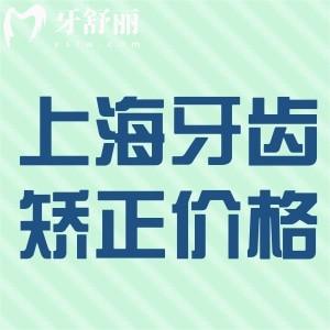 全新上海牙齿矫正价格表:全年龄金属矫正6000+隐形矫正20000+更划算