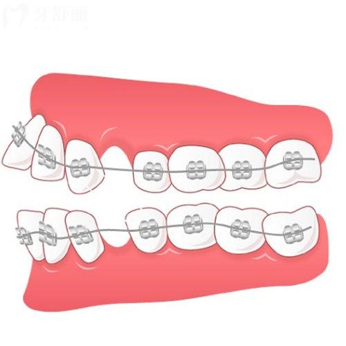 北京亦庄矫正牙齿价格表更新:这五家正规口腔做牙齿正畸收费很实惠