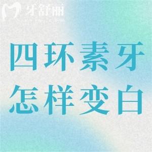 中度四环素牙怎样能变白