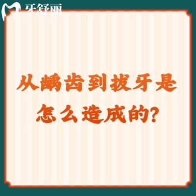 从龋齿到拔牙是怎么造成的？解密龋齿初期|中期|晚期的过程