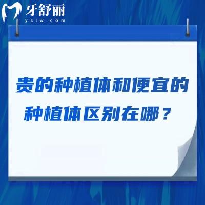 贵的种植体和便宜的种植体区别在哪？如何选择？一文知晓