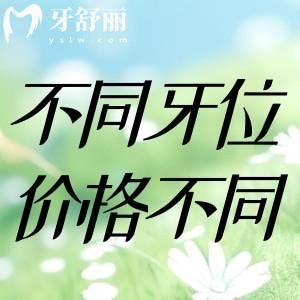 做补牙/拔牙/根管治疗时，前牙后牙磨牙的治疗费不同的原因你知道吗?