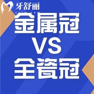 600元的金属冠和900元的全瓷冠哪个好?对比金属牙和全瓷牙三大区别就了解