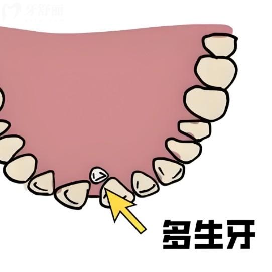 多生牙全年龄指南：儿童早发现，成人防病变，老人要当心